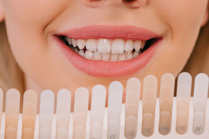 E-Max Lamine Kaplama