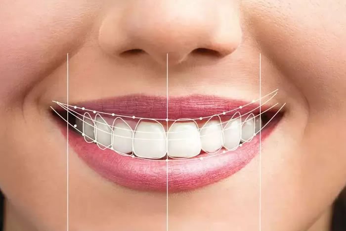 Estetik Diş Hekimliği